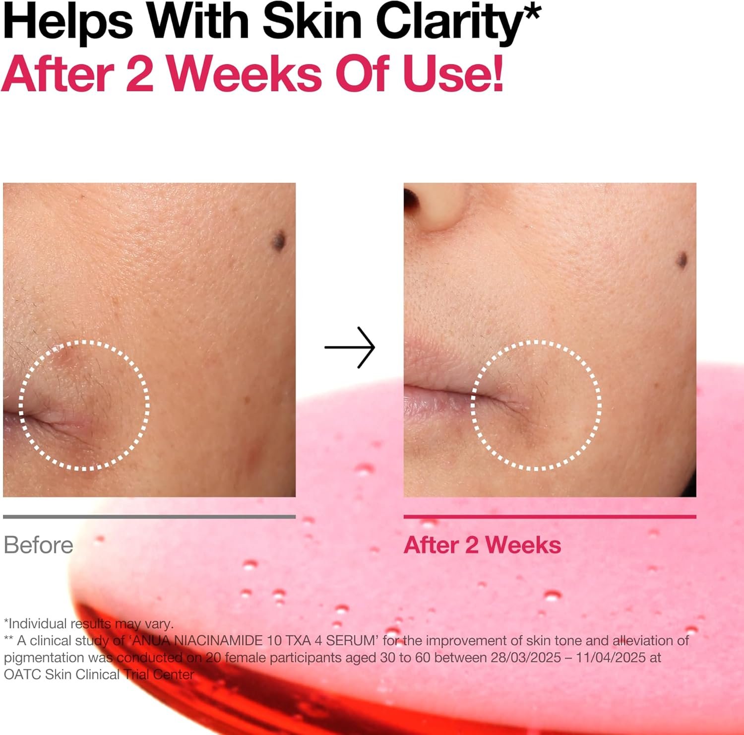 ANUA 10% Niacinamide + 4% TXA Serum (30ml) - Image 2